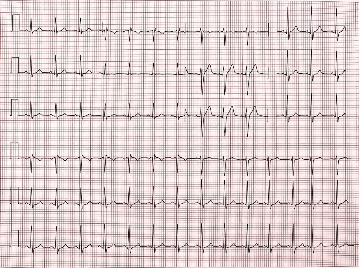 Image for question 401