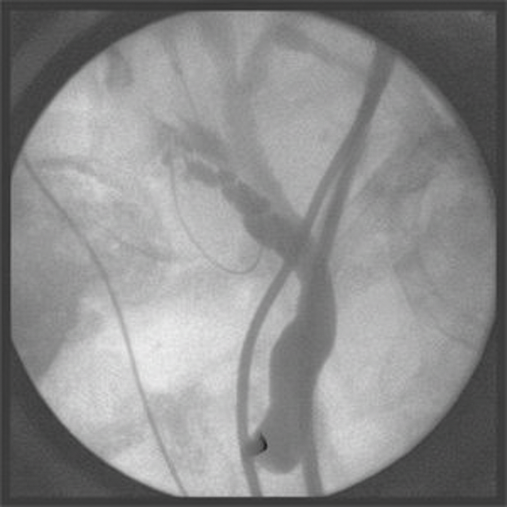 Image for question 51