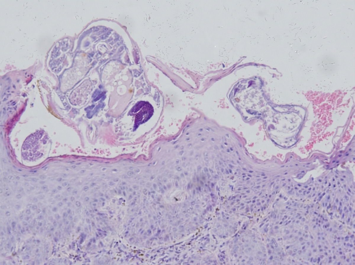 Image for question 82