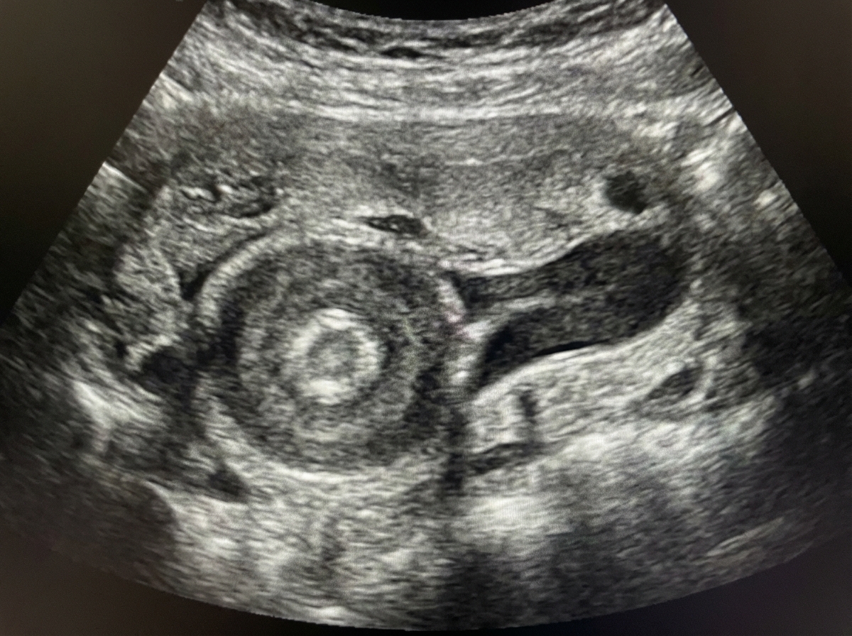 Image for question 50