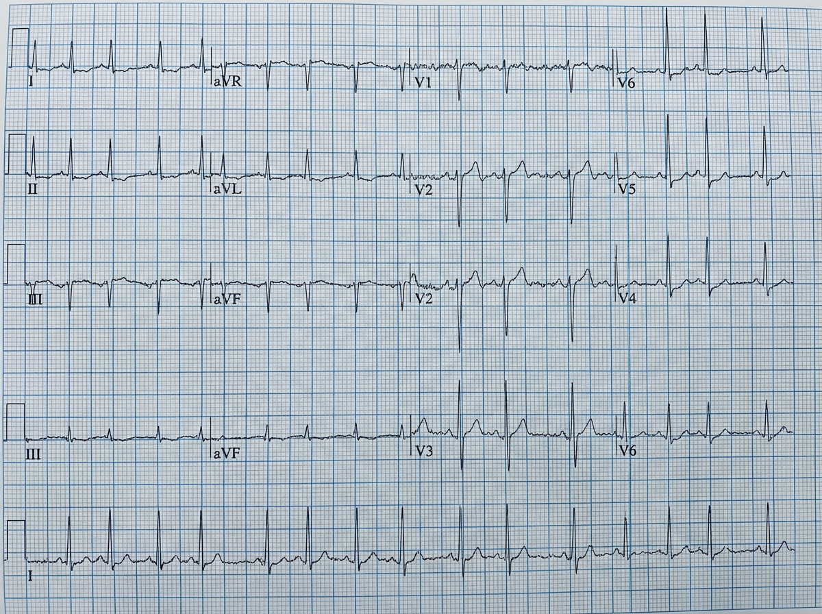 Image for question 12
