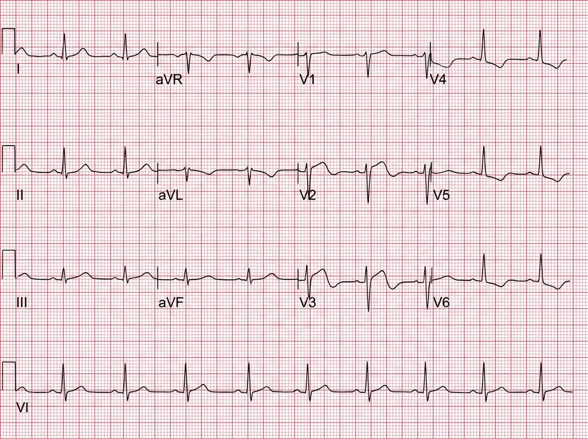 Image for question 1119