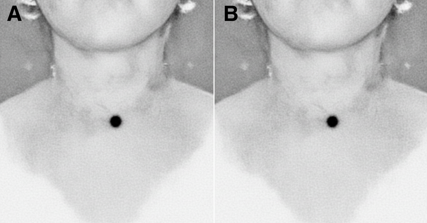 Image for question 463