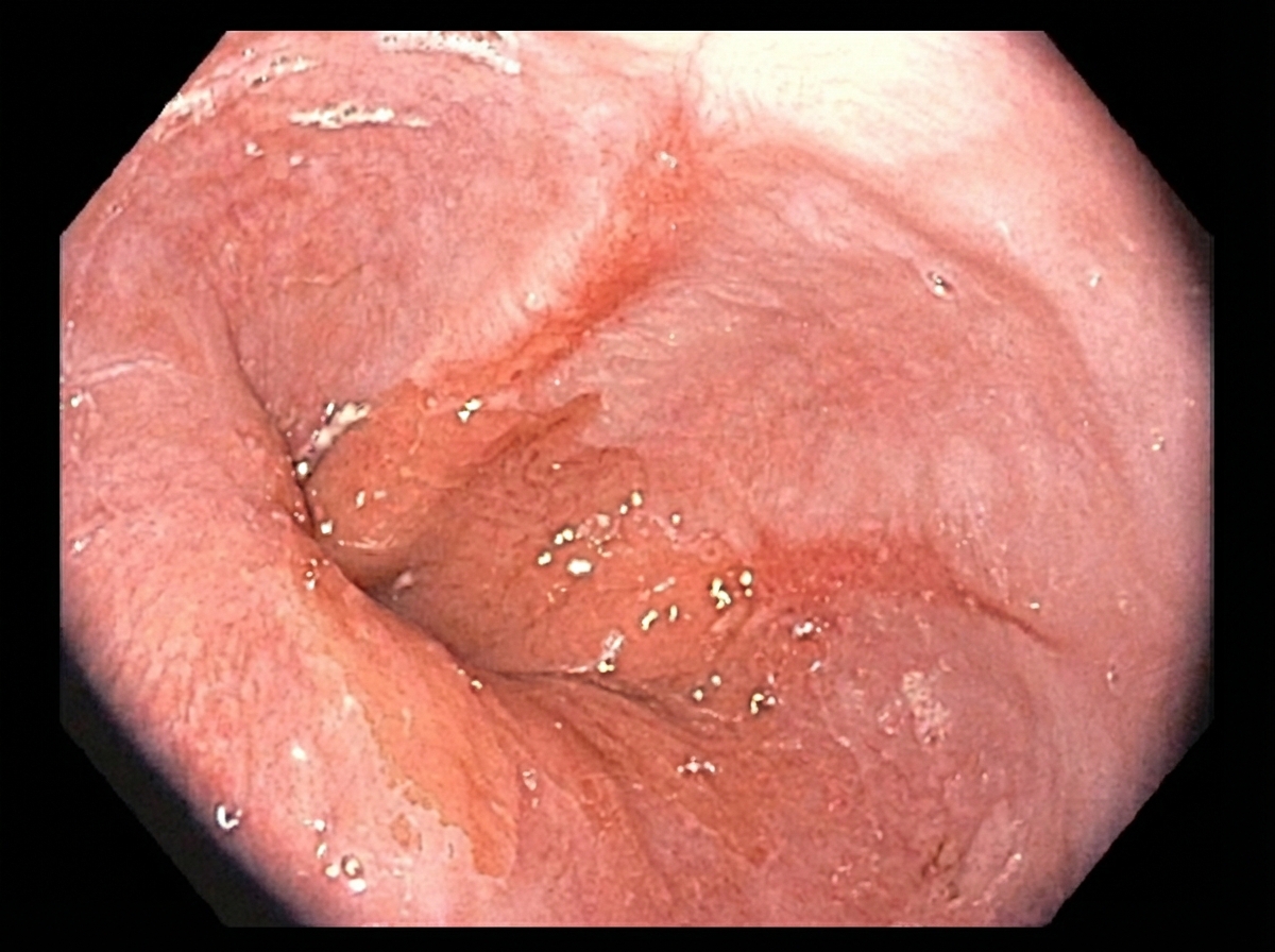 Image for question 395