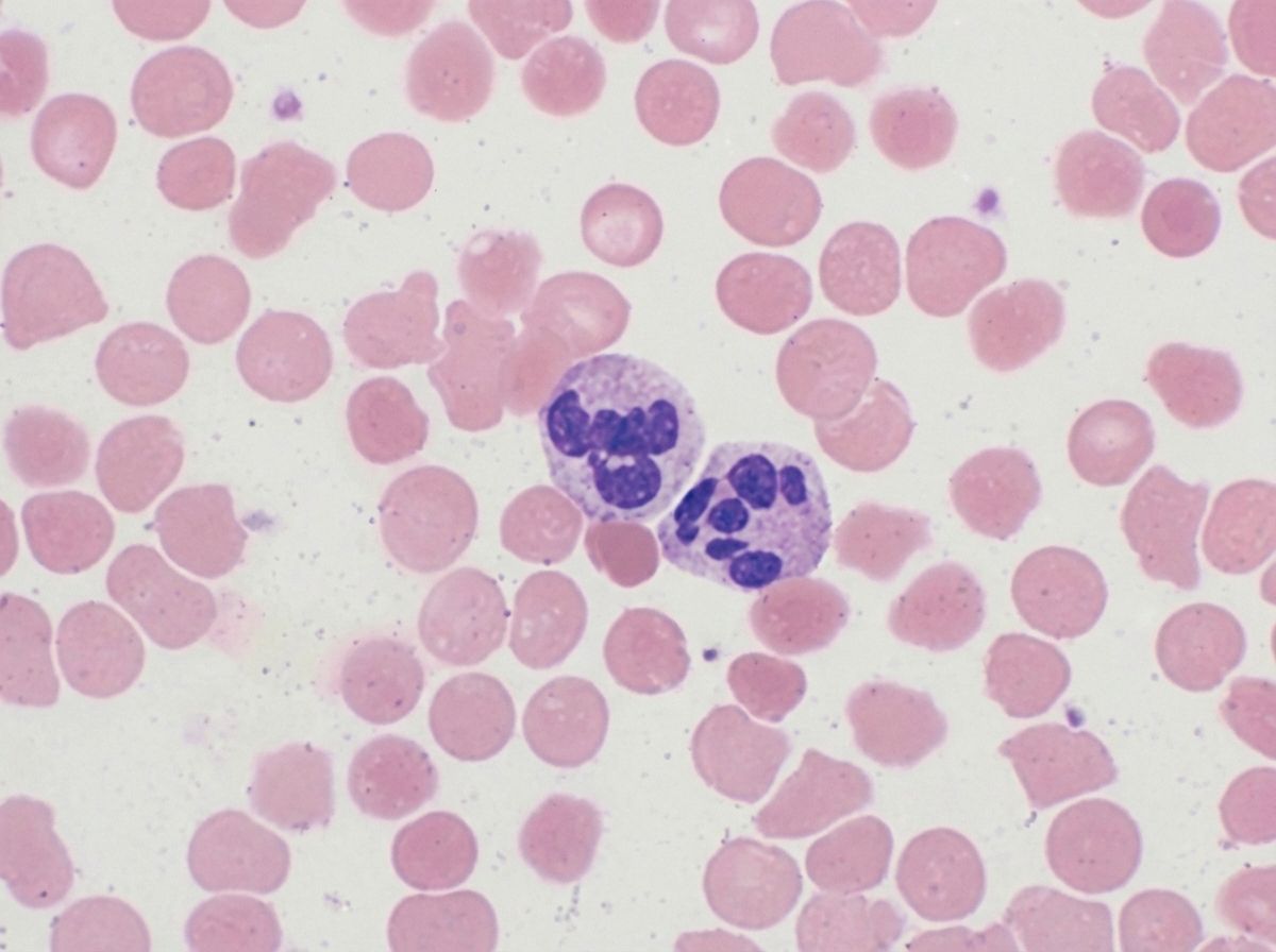 Image for question 80