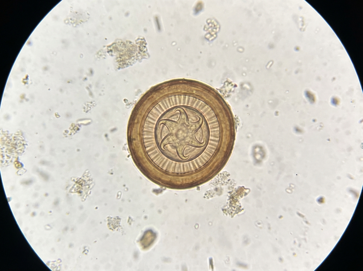 Image for question 119