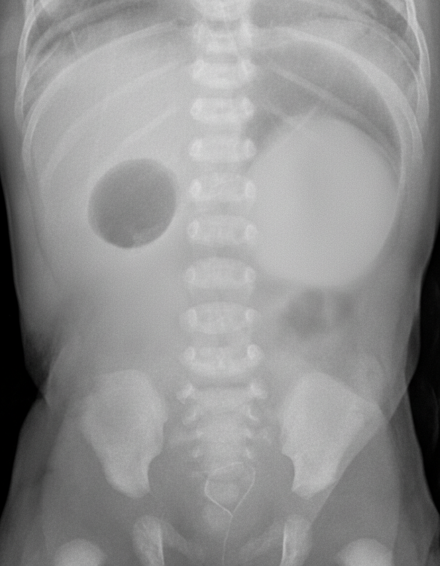 Image for question 223