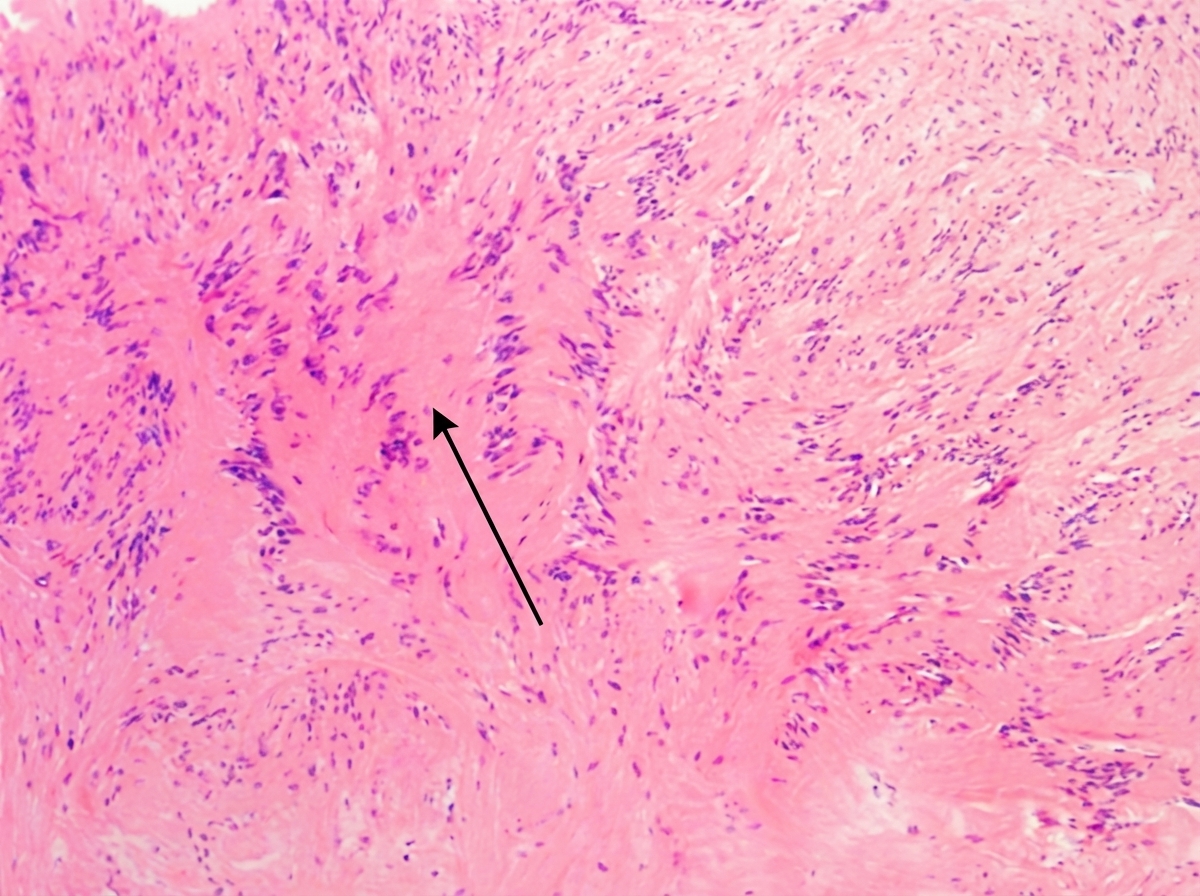 Image for question 218