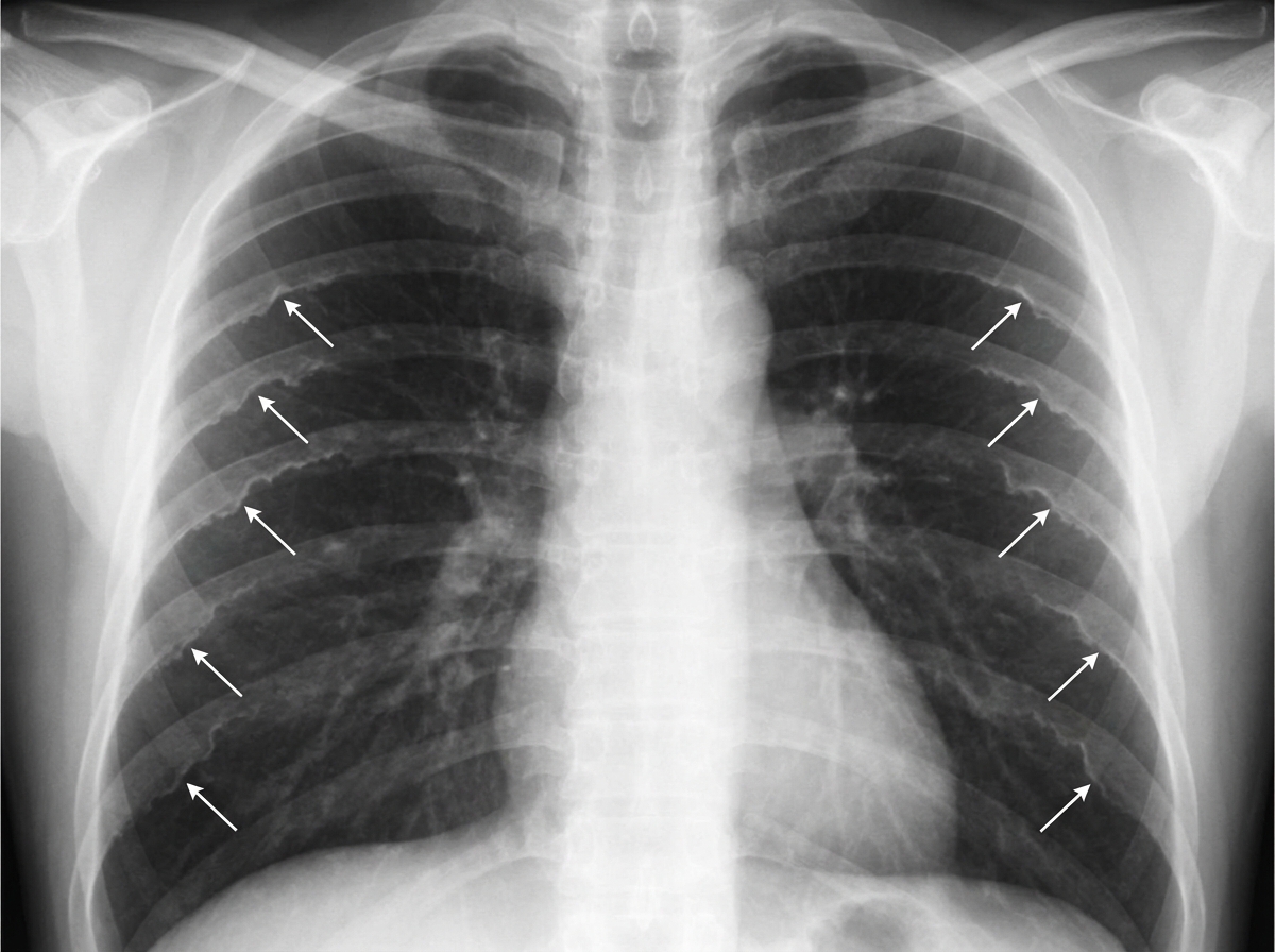 Image for question 75