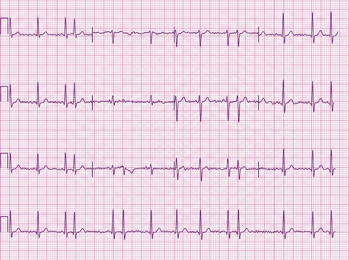 Image for question 16