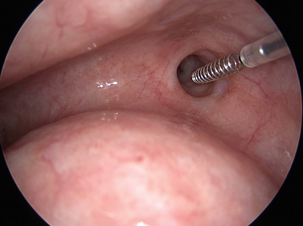 Image for question 117