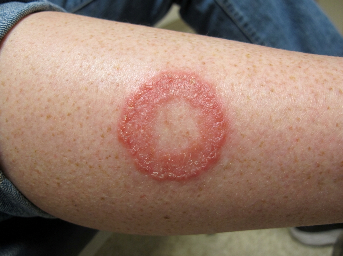 Image for question 943