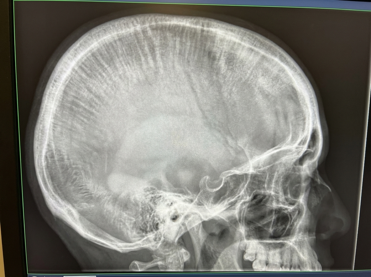 Image for question 101