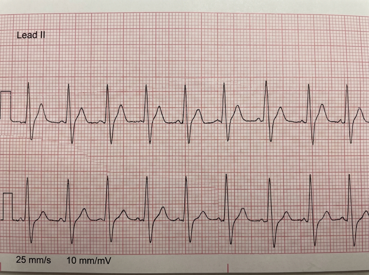 Image for question 31