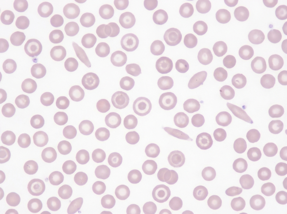 Image for question 317