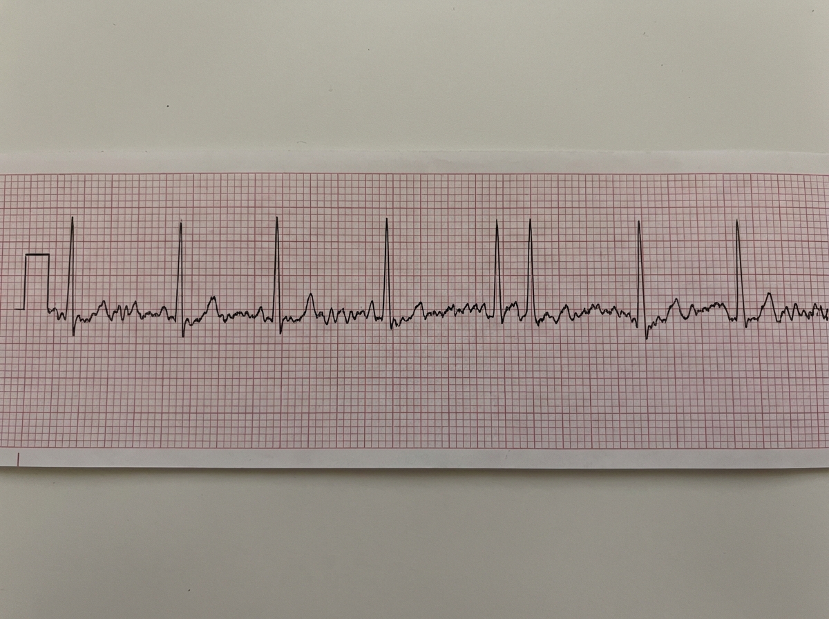 Image for question 239