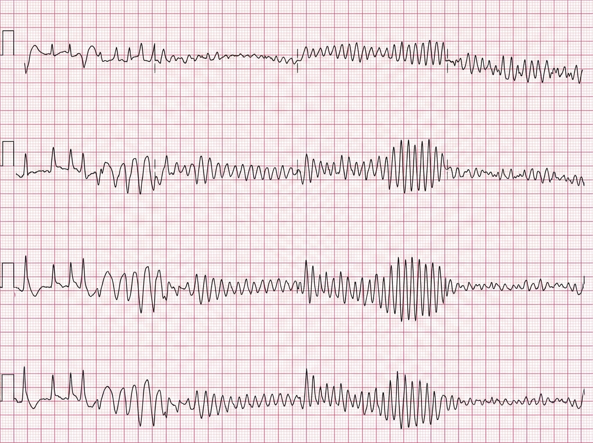 Image for question 13