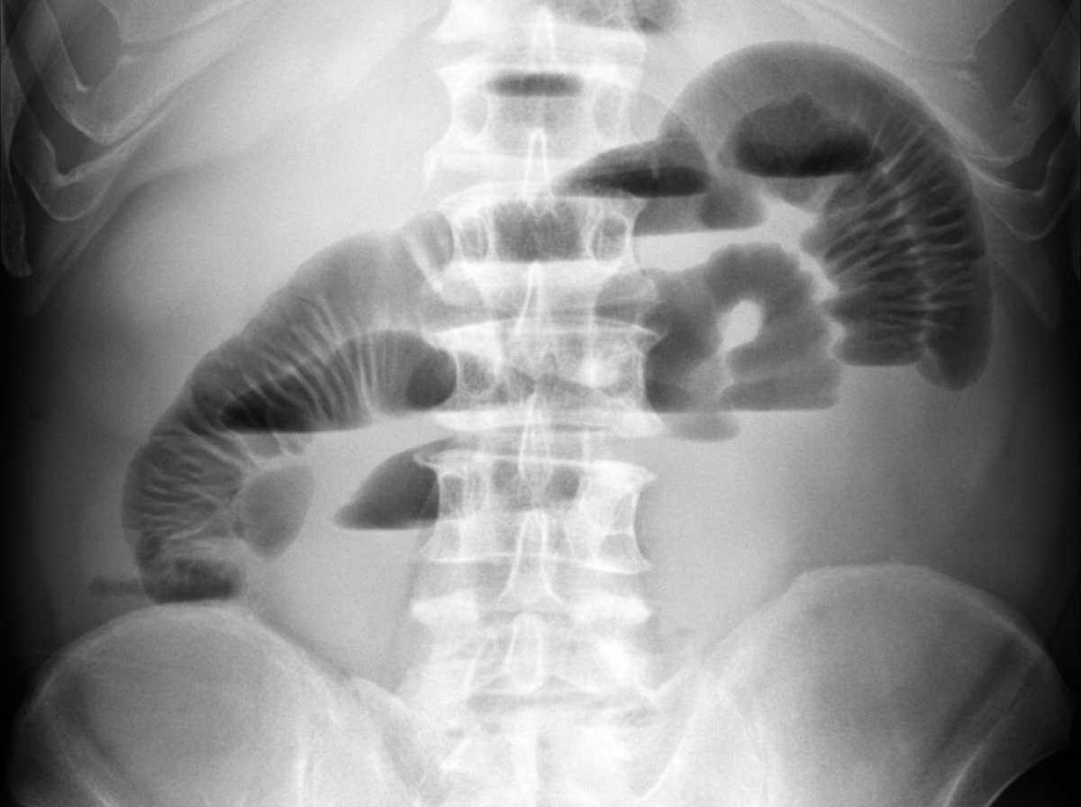 Image for question 804