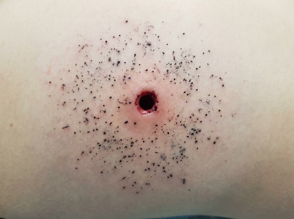 Image for question 311