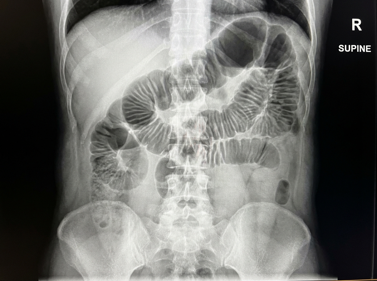 Image for question 197