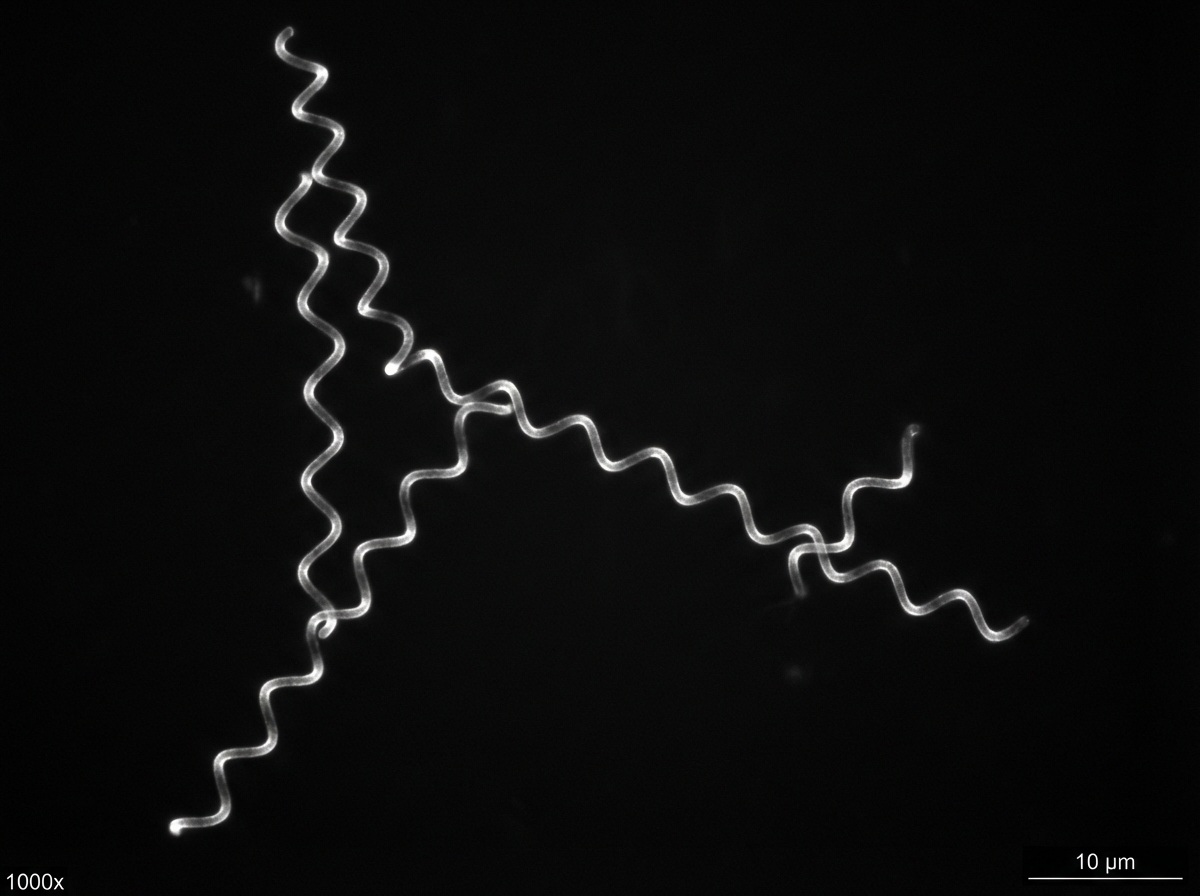 Image for question 1516