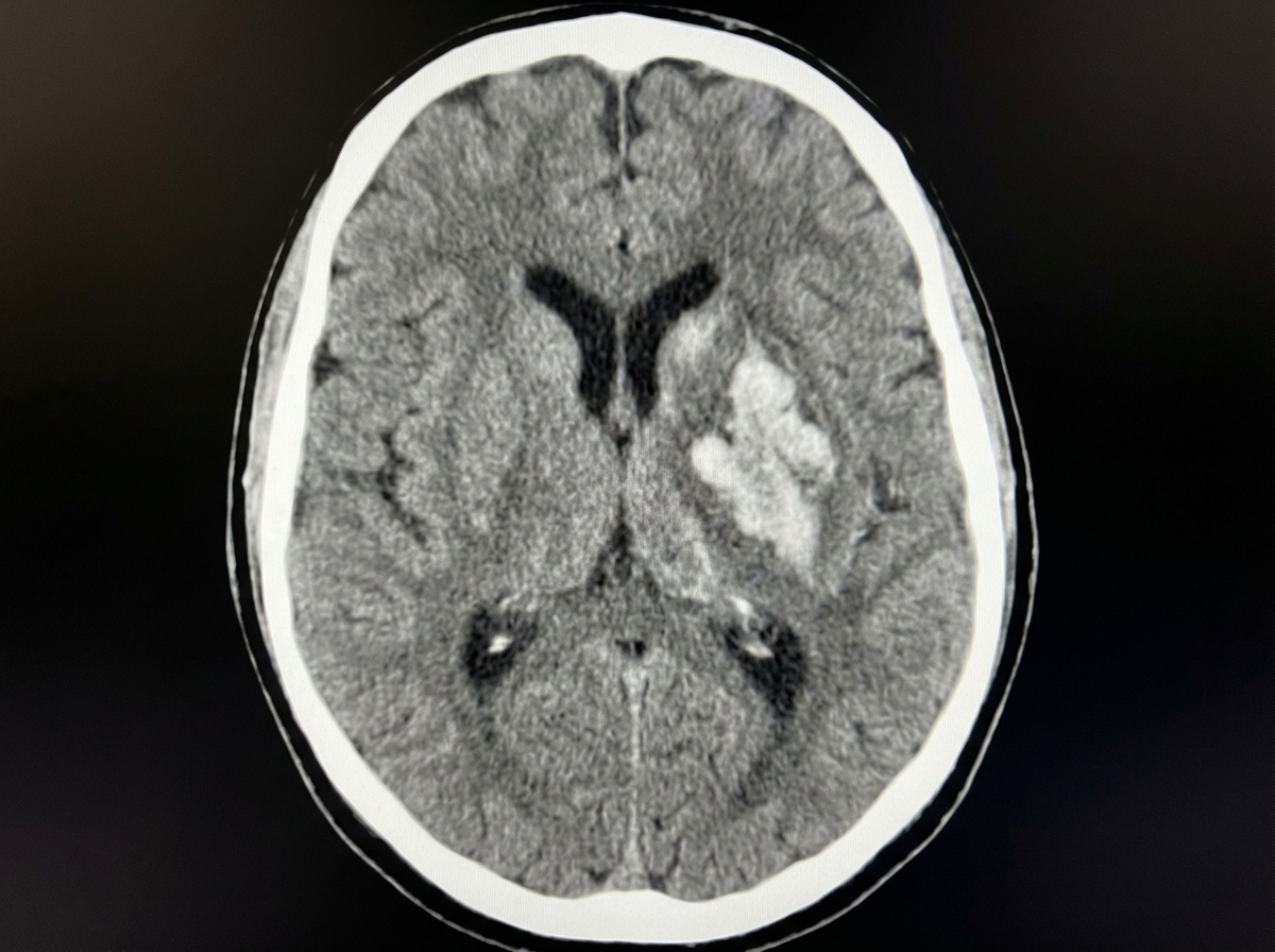 Image for question 1037