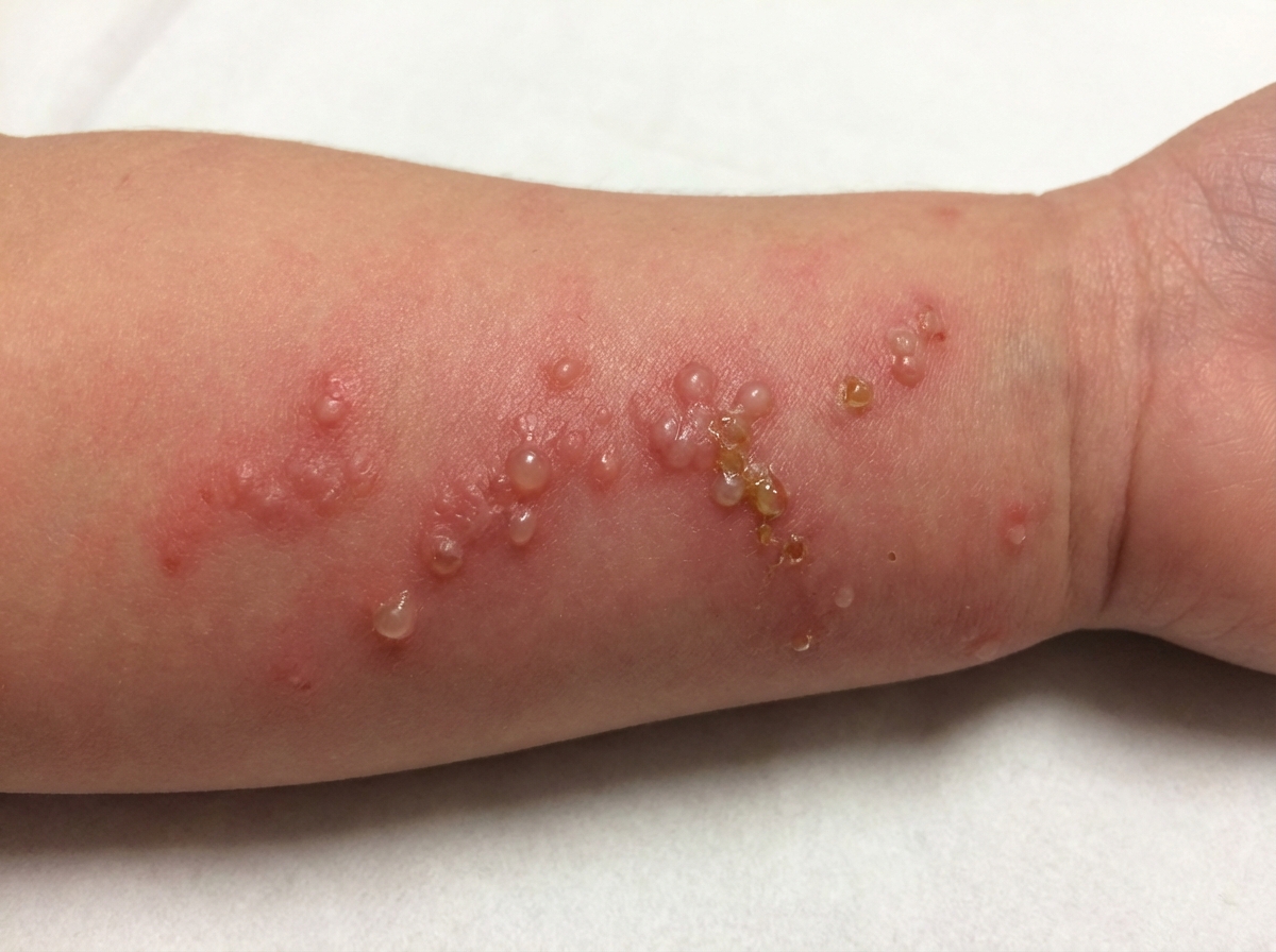 Image for question 32