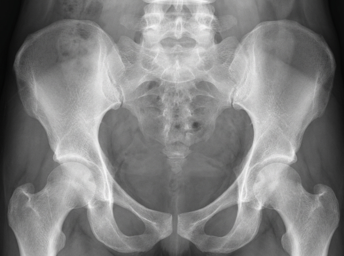 Image for question 150