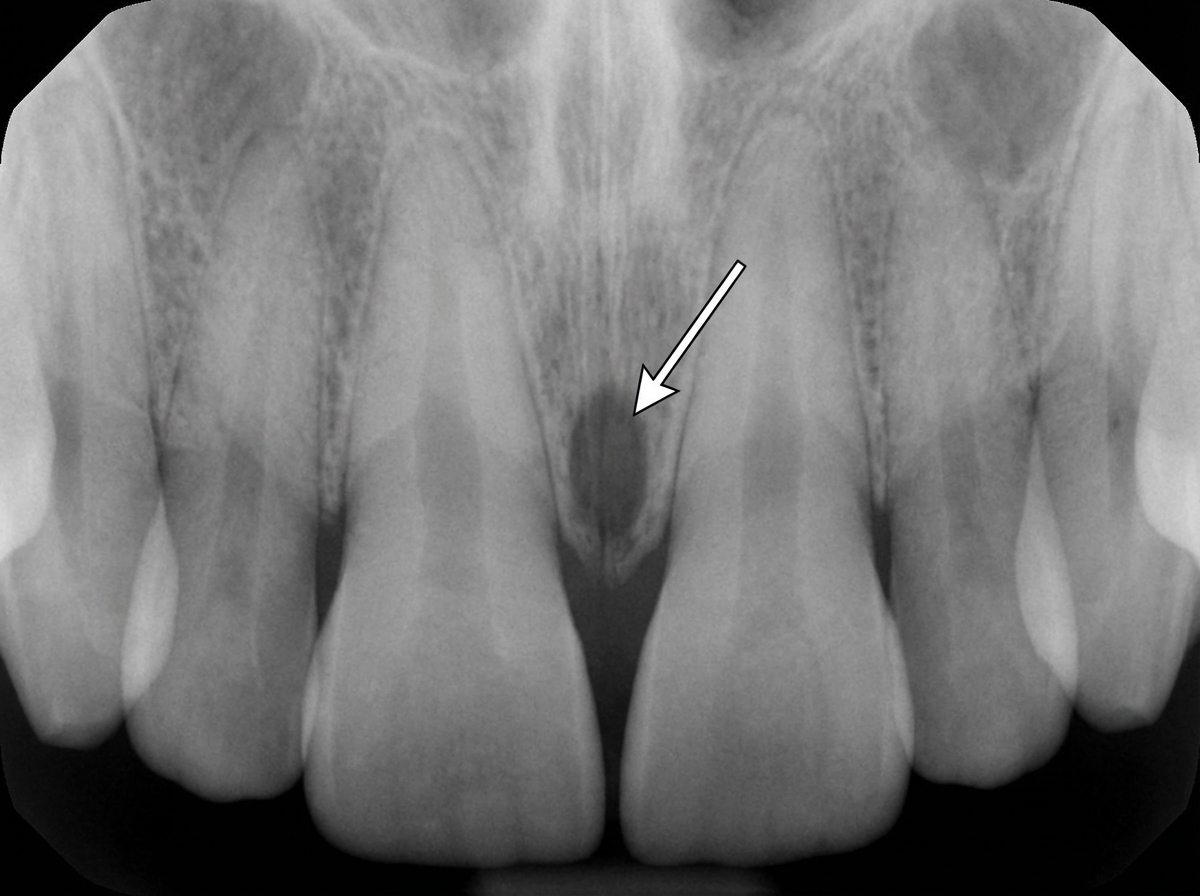 Image for question 33