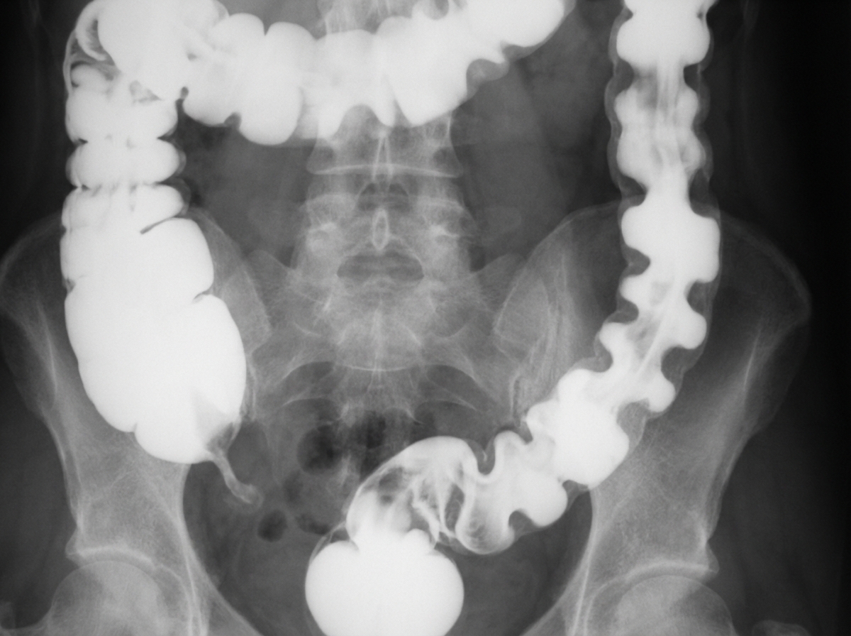 Image for question 216