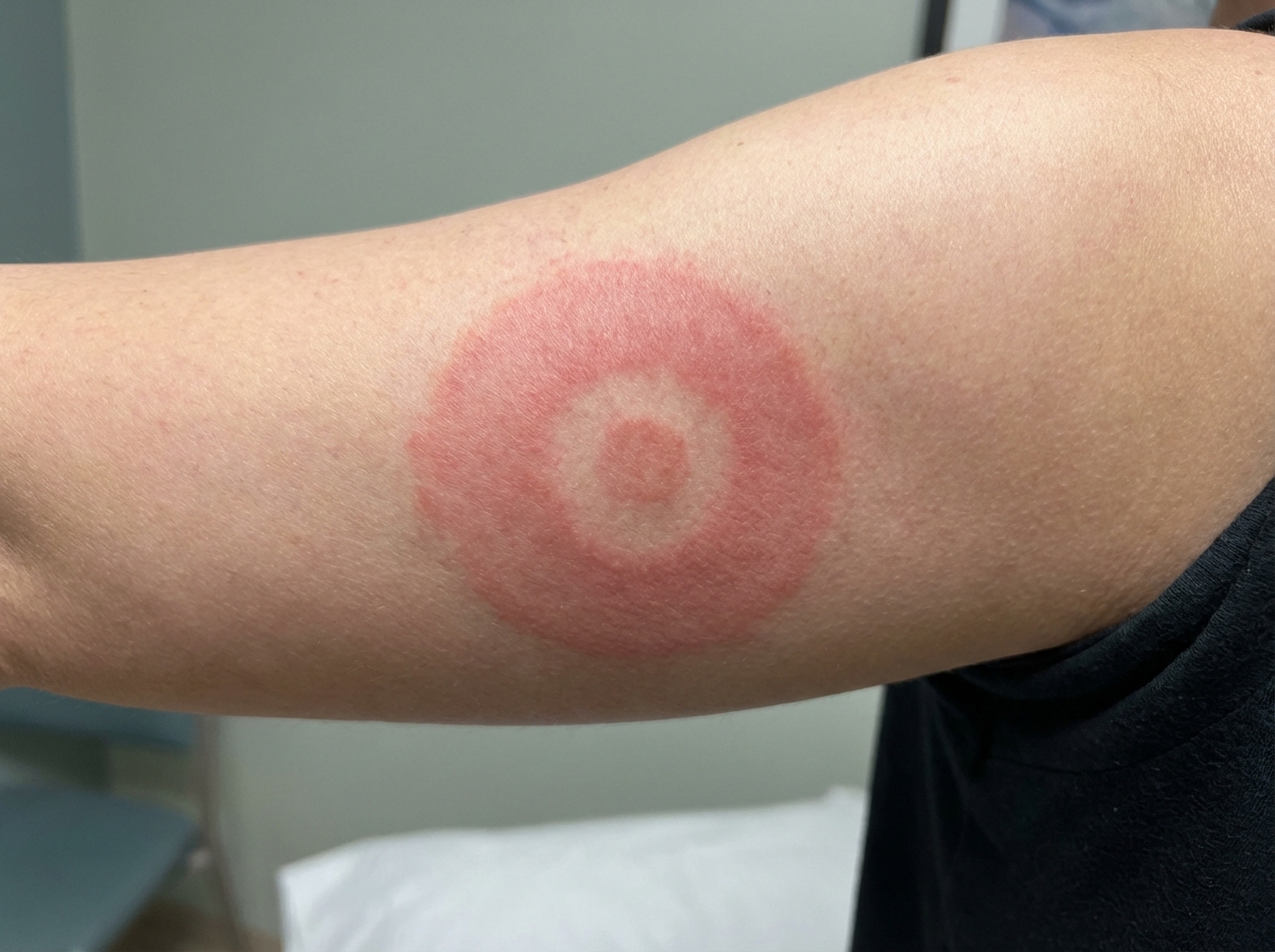 Image for question 132