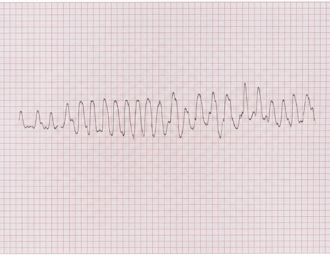 Image for question 709