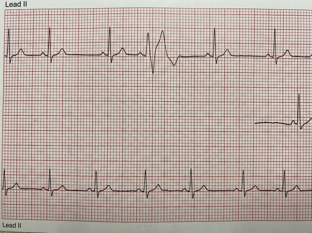 Image for question 69