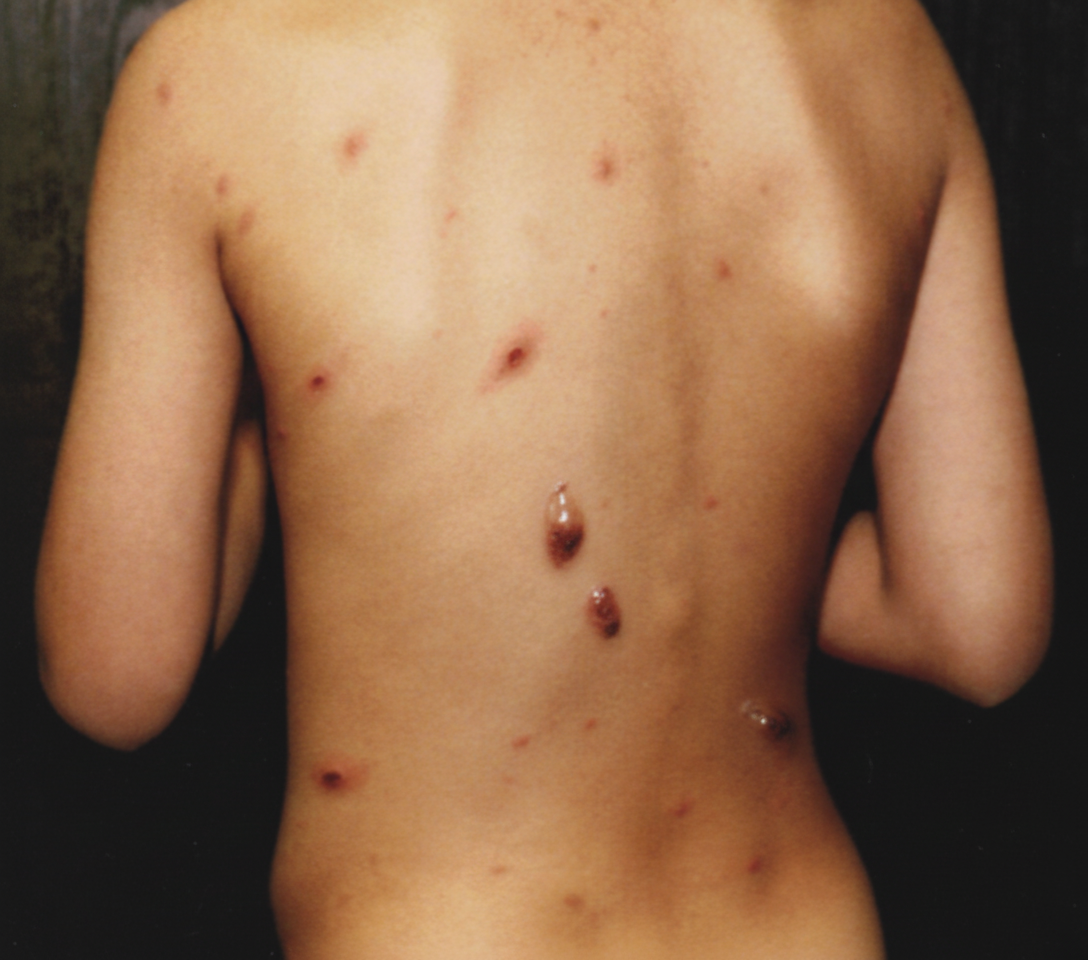 Image for question 147