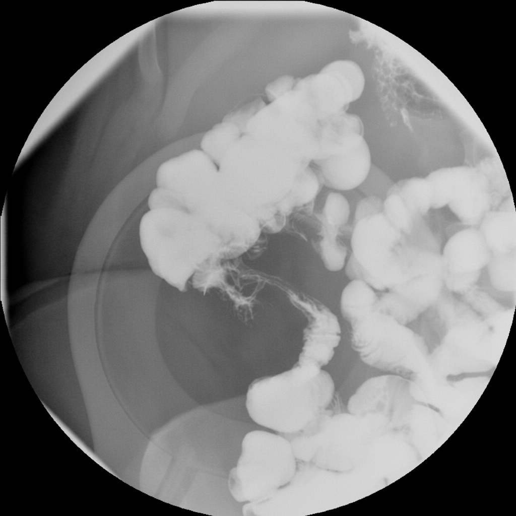 Image for question 278