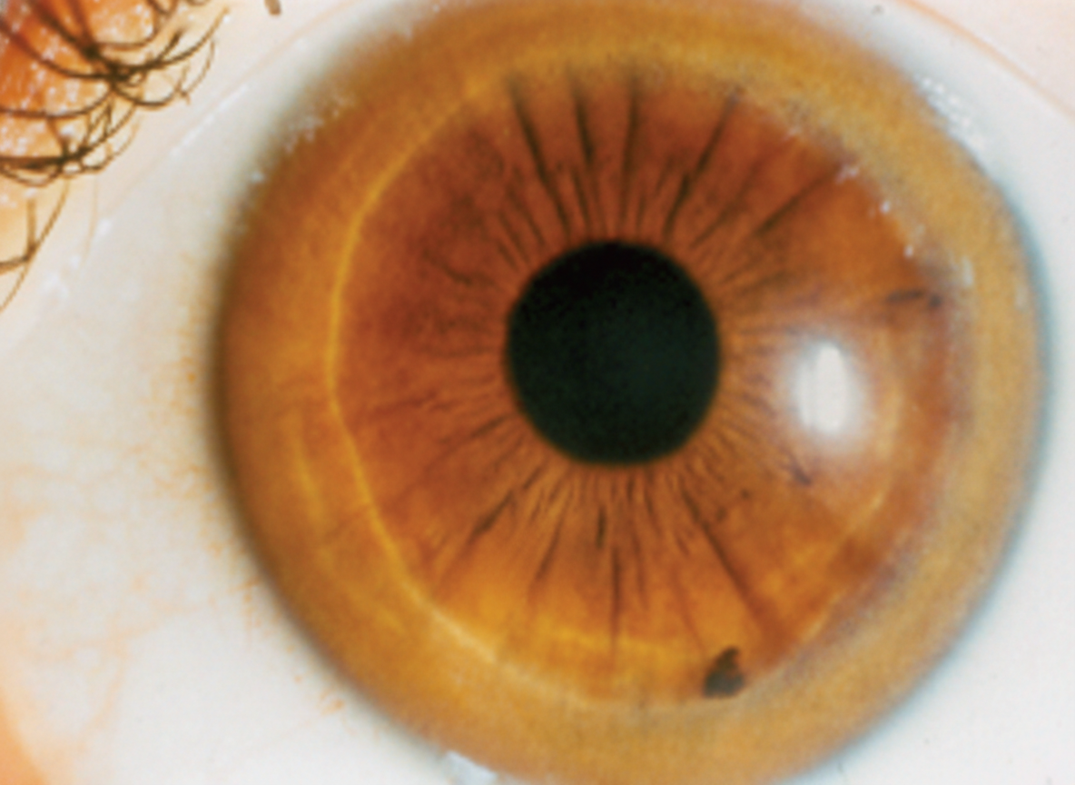 Image for question 90