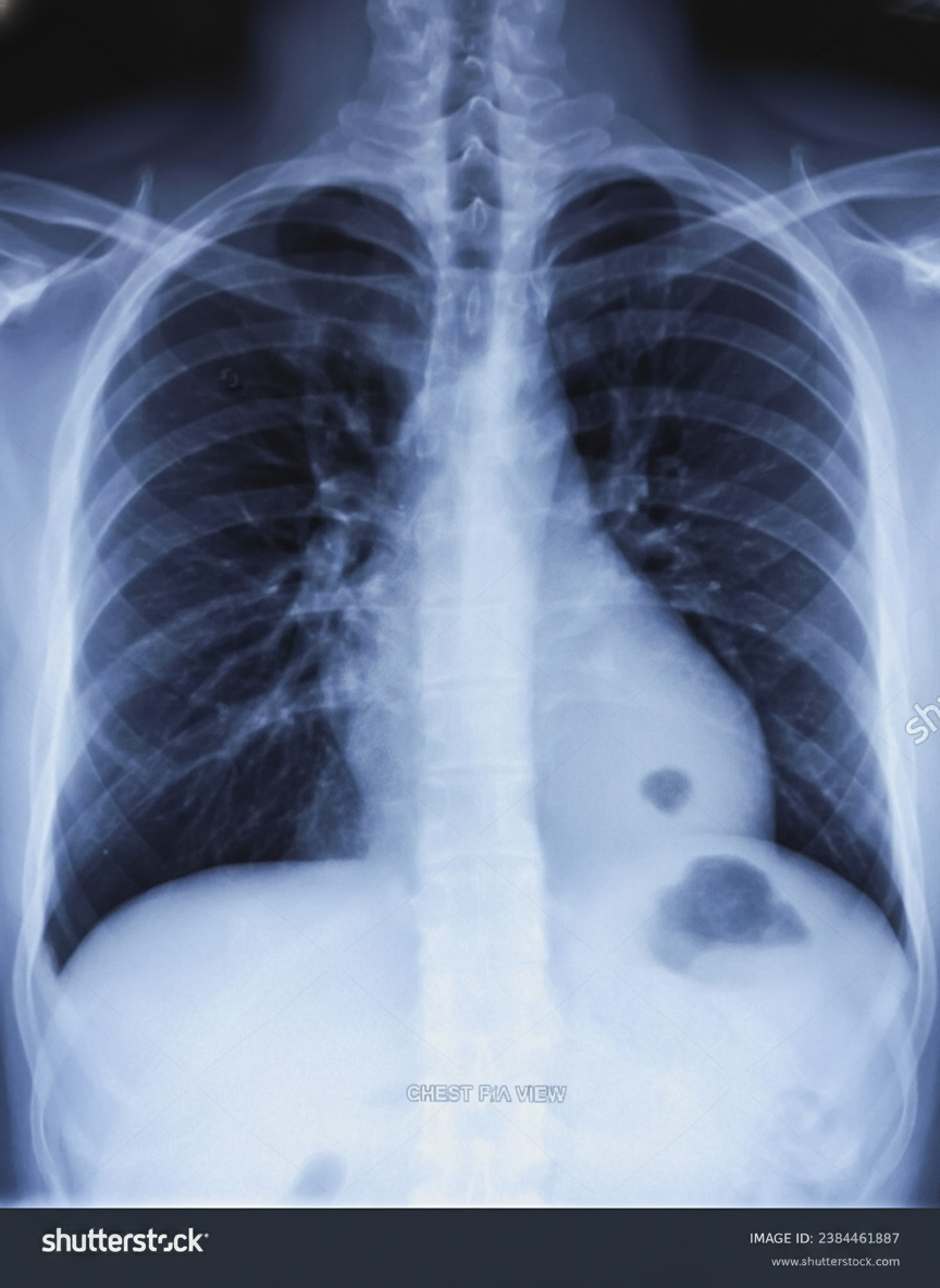 Image for question 12