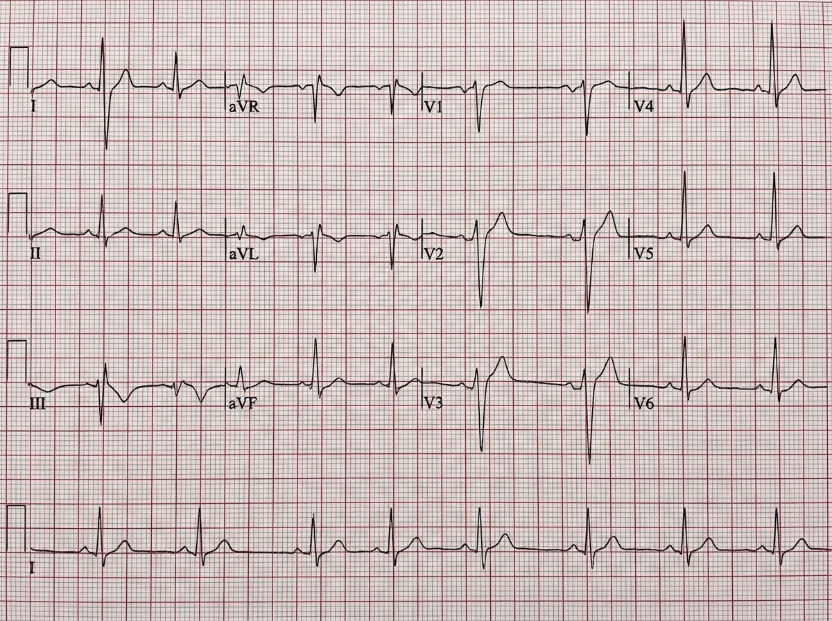 Image for question 24