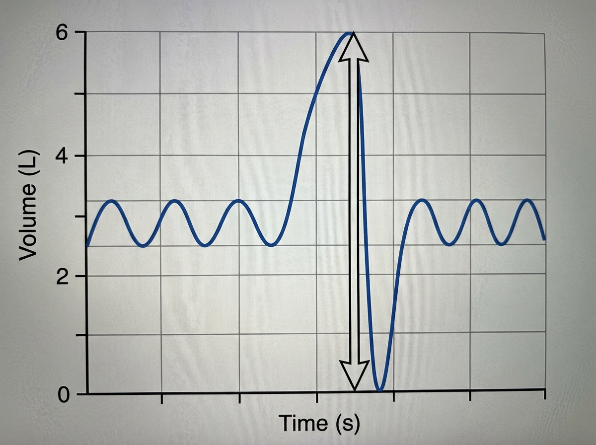 Image for question 441