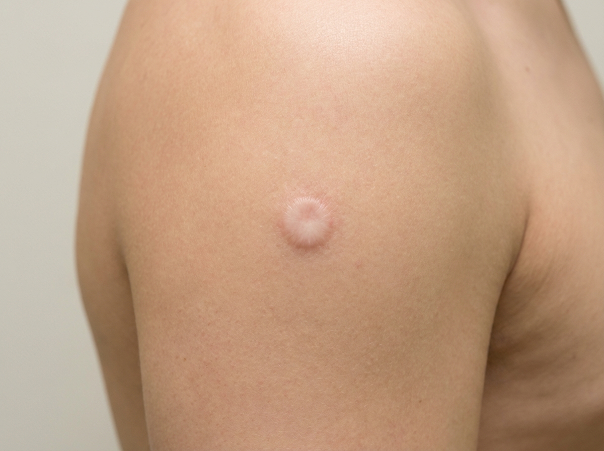 Image for question 47