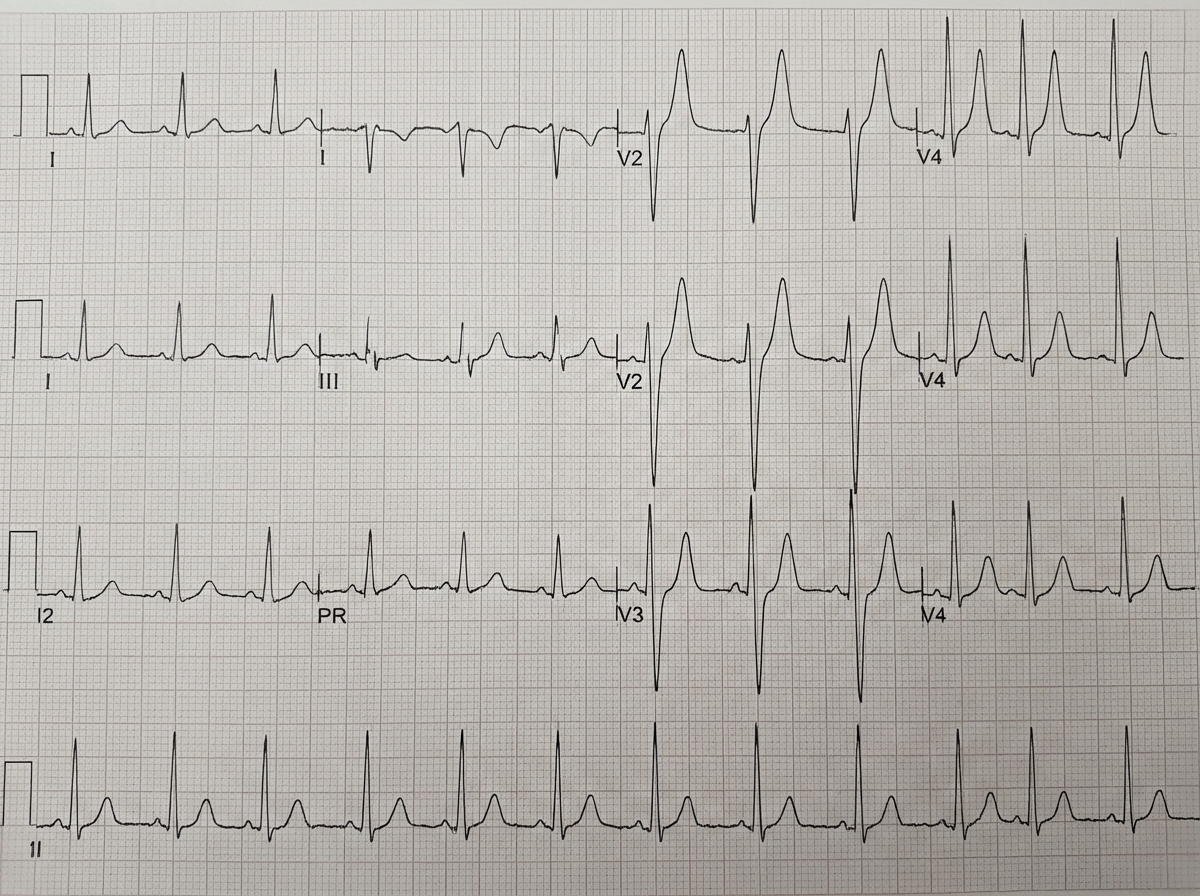 Image for question 620