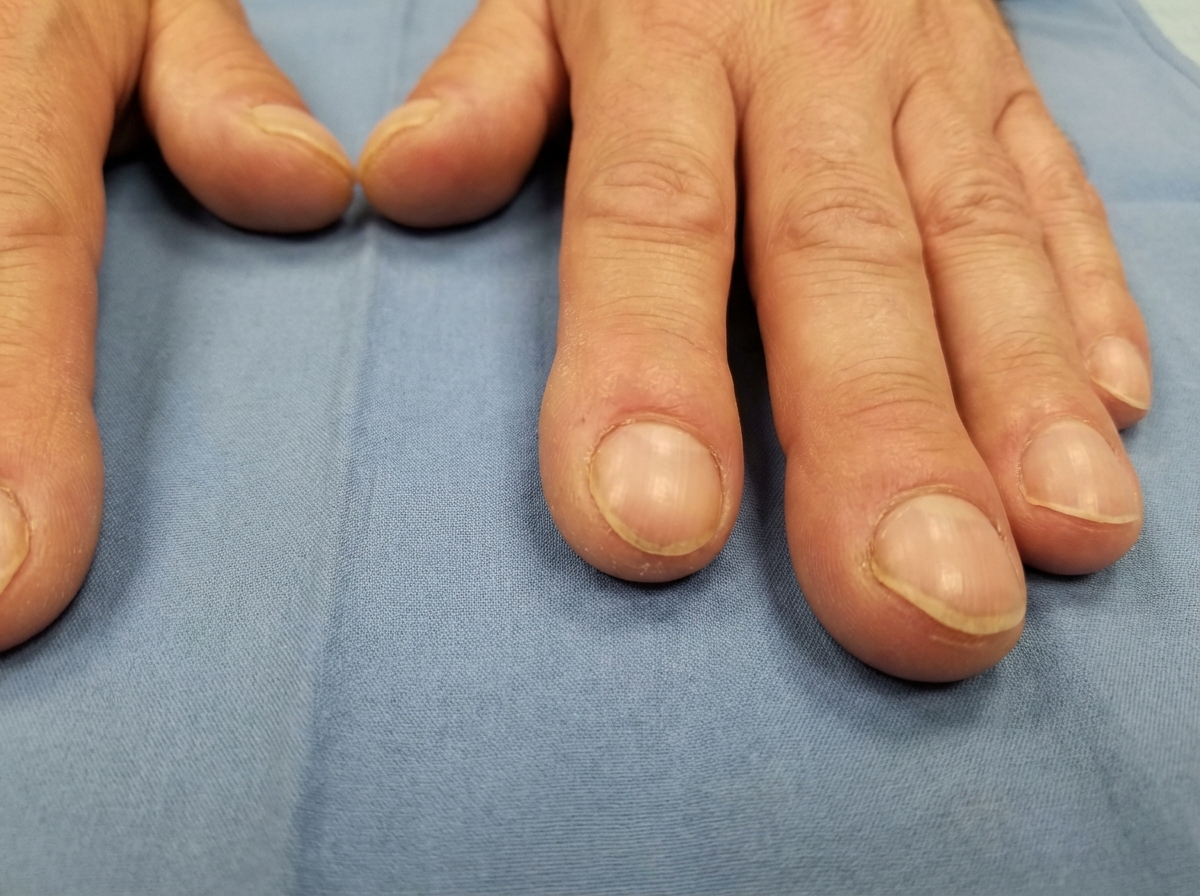 Image for question 99