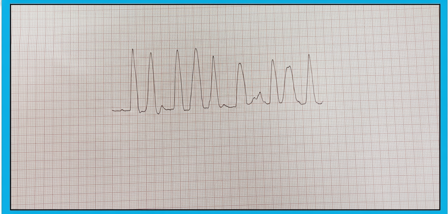 Image for question 5