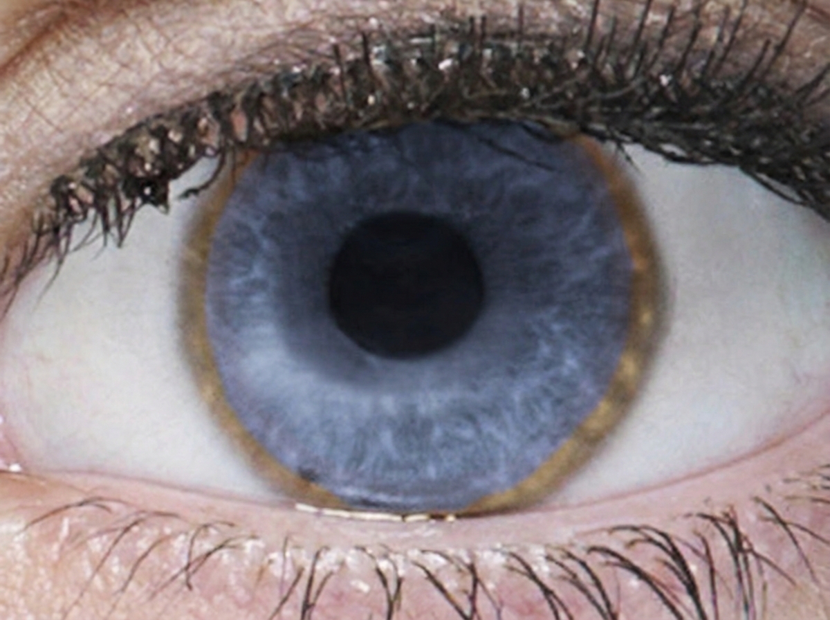 Image for question 132