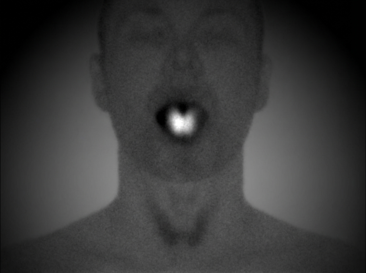 Image for question 44