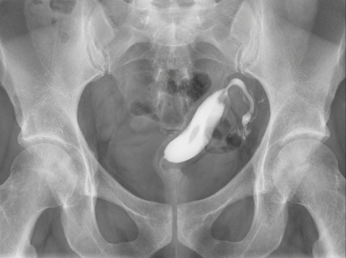 Image for question 147