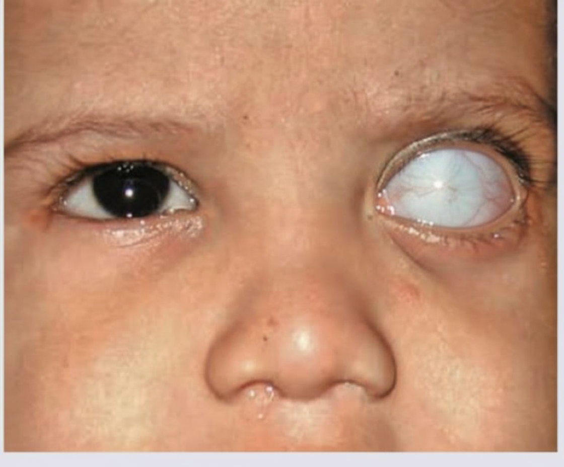 Image for question 321