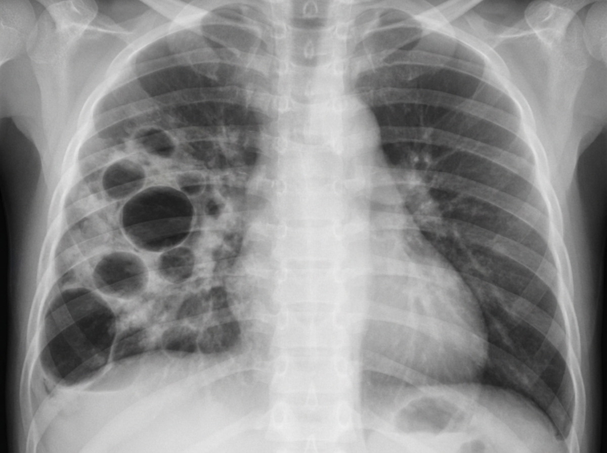 Image for question 155