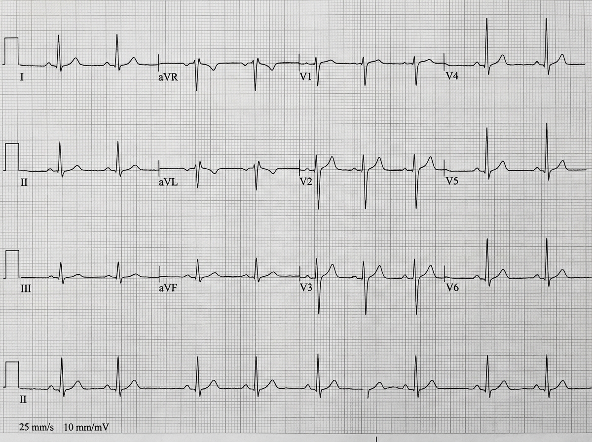 Image for question 844