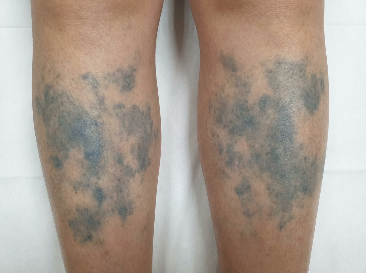 Image for question 234